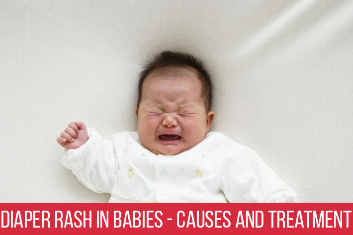Diaper Rash in Babies - What Causes and Treatment